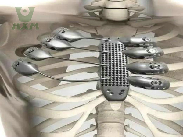 titanium alloy application
